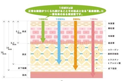 水玉リフティング|フェイスリフト - エステ美容商材卸販売